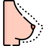 breast shape