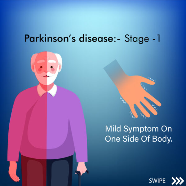 Parkinson’s Disease Symptoms Stage 1