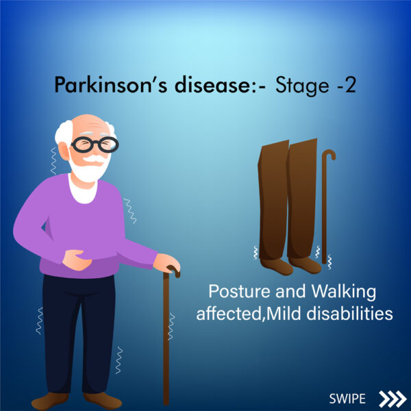 Parkinson’s Disease Symptoms Stage 2